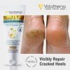 VOLAMENA HAND & FOOT REPAIR CREAM FOR BOTH MEN & WOMEN VOLAMENA HAND & FOOT REPAIR CREAM FOR BOTH MEN & WOMEN