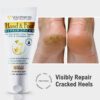 VOLAMENA HAND & FOOT REPAIR CREAM FOR BOTH MEN & WOMEN VOLAMENA HAND & FOOT REPAIR CREAM FOR BOTH MEN & WOMEN